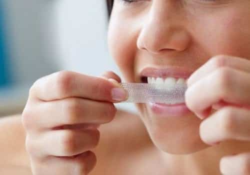 Competir Son amortiguar Blanqueadores dentales de libre venta: mejor evite – SwissDent
