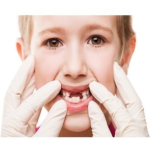 Sabes que causan dientes torcidos en los niños? – SwissDent