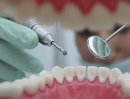 centro odontologico ica - dientes