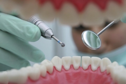 centro odontologico ica - dientes