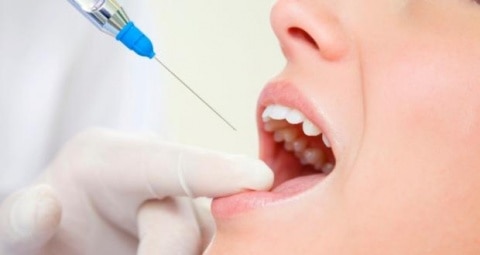 dentista ica -anestesia