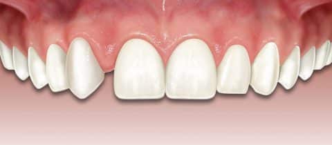 clinica dental Ica